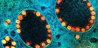 França identifica nova variante do coronavírus com mais de 40 mutações