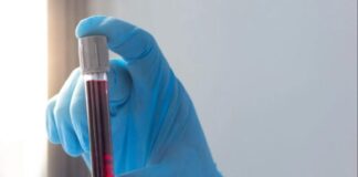 Última chance: Mais de 80% dos motoristas profissionais ainda não fizeram exame toxicológico