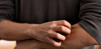 Seja por causas físicas ou emocionais: entenda quando a coceira vira um sinal de alerta